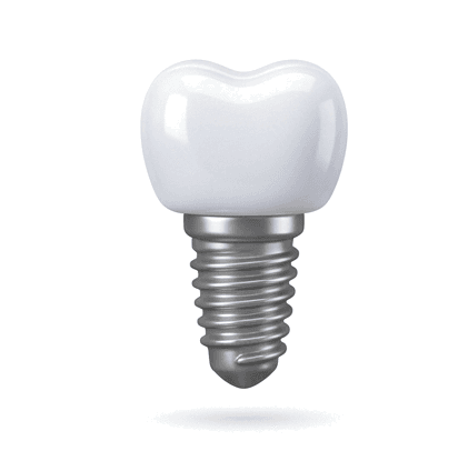 Implantes dentales